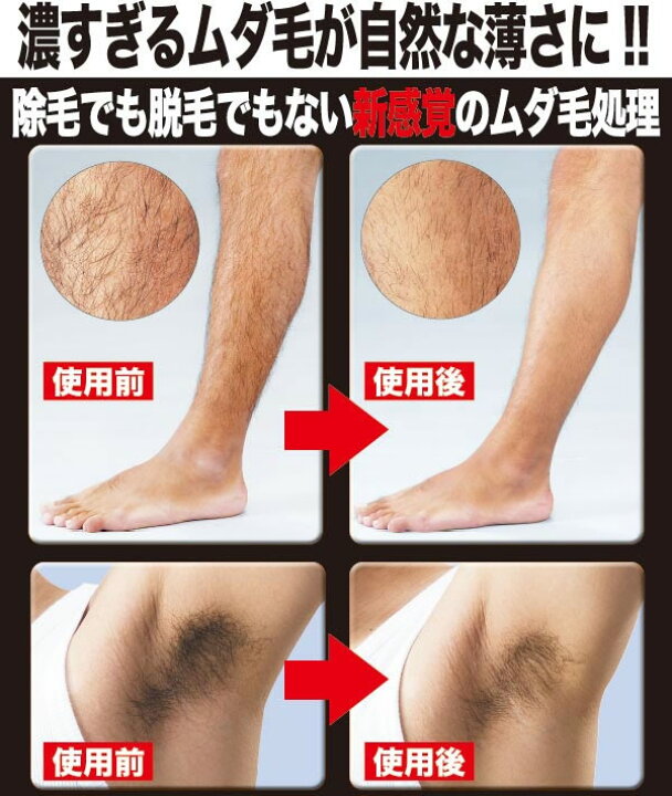 楽天市場 ムダ毛ジョリー メール便送料無料 胸毛 腕毛 スネ毛 梳く 薄くする すね毛 カミソリ 処理 キャンディコムウェア