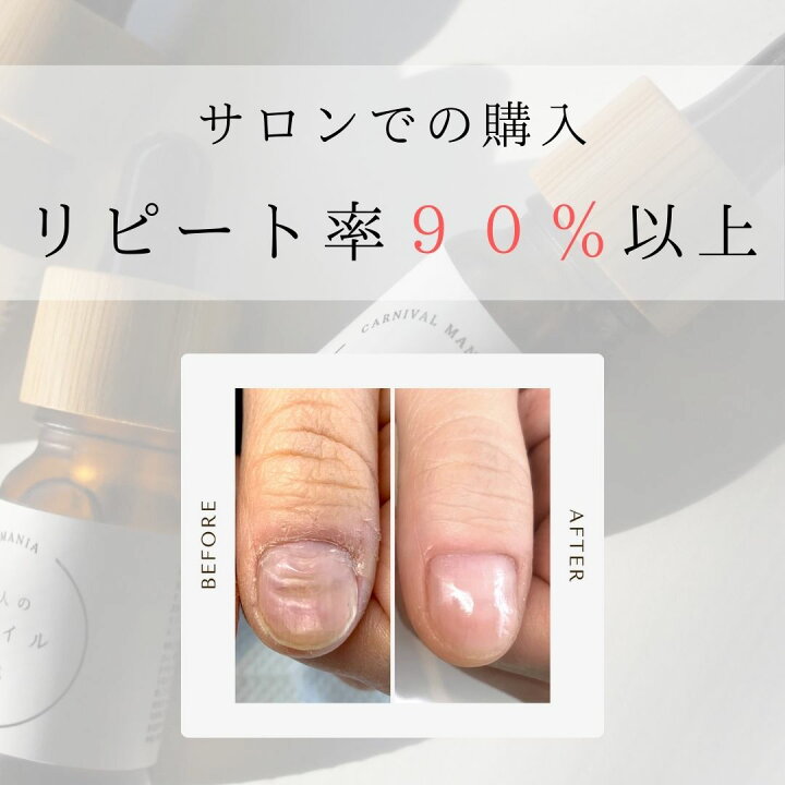 楽天市場】【ジェル爪 5本セット 】 ネイルオイル 爪 オイル 