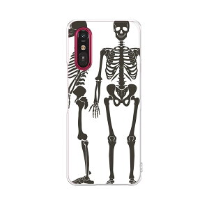 炭炭X}[gtH a A401FC p a401fc P[X Jo[ n[hP[X 013822 [@͌^