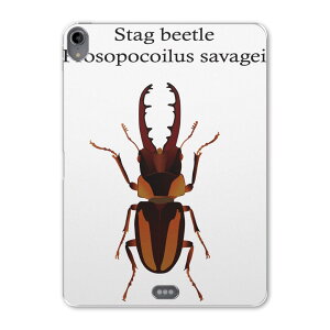 iPad Pro 11 1 2018N p P[X \tg TPUP[X A1980 A2013 A1934 Ή ^ubgP[X ^ubgJo[ 020006  stag beetle NK^V