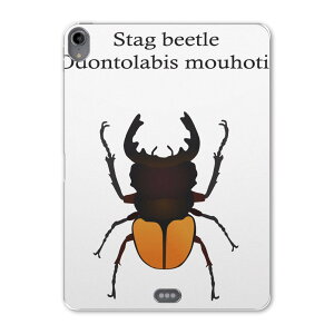 iPad Pro 11 1 2018N p P[X \tg TPUP[X A1980 A2013 A1934 Ή ^ubgP[X ^ubgJo[ 020008  stag beetle NK^V