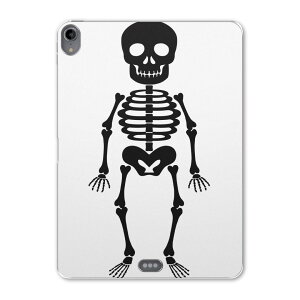 iPad Pro 11 ��1���� 2018�N�� �p �P�[�X �\�t�g TPU�P�[�X A1980 A2013 A1934 �Ή� �^�u���b�g�P�[�X �^�u���b�g�J�o�[ 017444 �n���E�B���@�z���[ �K�C�R�c�@�[���@���m�g�[��