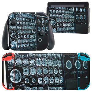 igsticker Nintendo Switch p fUCXLV[ CV jeh[ XCb` p {̃hbN Joy-Con Joycon WCR p Q[@ Jo[ ANZT[ tB XebJ[ 023989 gQ