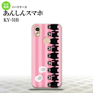 KY-51B KY-51B X}zP[X n[hP[X ܃ XgCv sN Y fB[X nk-ky51b-km11