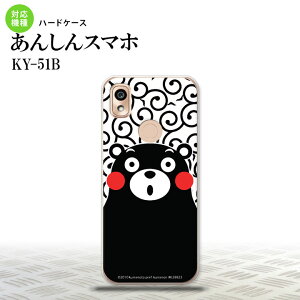 KY-51B KY-51B X}zP[X n[hP[X ܃    Y fB[X nk-ky51b-km28