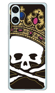 �X�J���L���O TYPE2 �i�\�t�gTPU�N���A�j au SOG14 Xperia 10 VI�Edocomo SO-52E Xperia 10 VI�Esoftbank A402SO Xperia 10 VI�EMVNO�X�}�z�iSIM�t���[�[���j XQ-ES44 Xperia 10 VI SECOND SKIN �\�t�g�P�[�X Xperia �P�[�X ��������