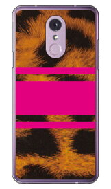 ROTM Leopard ピンク （クリア） design by ROTM LG Q Stylus MVNOスマホ（SIMフリー端末） SECOND SKIN lgq stylus ケース lgq stylus カバー lgqstylus ケース lgqstylus カバー lgqstylusケース lgqstylusカバー lgq stylusケース 送料無料