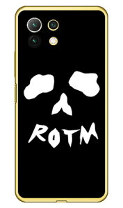 Face bone �u���b�N �i�N���A�j design by ROTM Mi 11 Lite 5G M2101K9R MVNO�X�}�z�iSIM�t���[�[���j SECOND SKIN �n�[�h�P�[�X mi 11 lite 5g m2101k9r �X�}�z mi 11 lite 5g m2101k9r �X�}�[�g�t�H�� mi 11 lite 5g m2101k9r mi 11 lit