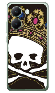�X�J���L���O TYPE2POCO X7 Pro (�\�t�gTPU) SECOND SKIN �P�[�X �J�o�[ �X�}�z�P�[�X �������� �ϏՌ� �v�����g �ی� �Ռ��z