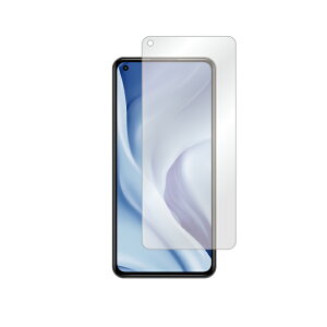 �����o�� Mi 11 Lite 5G M2101K9R MVNO�X�}�z�iSIM�t���[�[���j �ی�t�B���� M2101K9R �t�B���� �ی�t�B���� �ی�V�[�g �ی�t�B���� ���� �ی�t�B���� �ی� �t�B���� �V�[�g �t�B���� �V�[�g �ی�