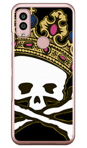 XJLO TYPE2 iNAj Android One S10 Y!mobile SECOND SKIN ZJhXL  󒍐Y X}zP[Xandroid one s10 P[X android one s10 Jo[ AhChs10P[X AhChs10
