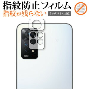 Xiaomi Redmi Note 11 Pro [ Yӕp ] یtB wh~ NA یtB jgs bgt ݊i