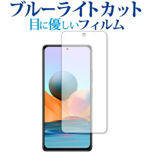 Xiaomi Redmi Note 10 Pro 5G ی tB u[CgJbg ˖h~ یtB wh~ [֑ jgs bgt ݊i