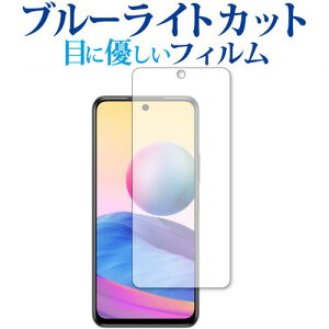 Redmi Note 10 JE ی tB u[CgJbg ˖h~ یtB wh~ [֑ jgs bgt ݊i