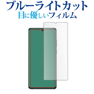 OnePlus 12 tی tB u[CgJbg ˖h~ یtB wh~ [֑ jgs bgt ݊i