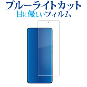 Xiaomi Redmi Note 13 Pro+ 5G tی tB u[CgJbg ˖h~ یtB wh~ [֑ jgs bgt ݊i