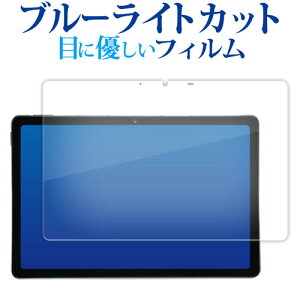 AGM PAD P2 [ ʗp ] 11C` tی tB u[CgJbg ˖h~ یtB wh~ [֑ jgs bgt ݊i