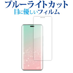 ���f�B�A�J�o�[�}�[�P�b�g Honor Magic6 Pro �t���ی� �t�B���� �݊��i �u���[���C�g�J�b�g ���˖h�~ �ی�t�B���� �w��h�~ ���[���֑�������