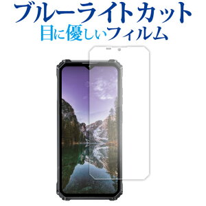 OUKITEL G1 �t���ی� �t�B���� �݊��i �u���[���C�g�J�b�g ���˖h�~ �ی�t�B���� �w��h�~ �y���f�B�A�J�o�[�}�[�P�b�g�z