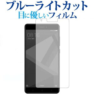 Xiaomi Redmi Note 4X/xiaomip u[CgJbg ˖h~ tیtB wh~ ttB [֑ jgs bgt ݊i