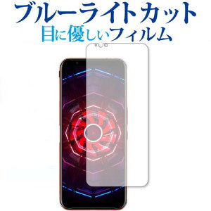 _X[p[SALE5őP13{!!^ nubia Red Magic 3 / ZTE p u[CgJbg ˖h~ tیtB [֑ jgs bgt ݊i