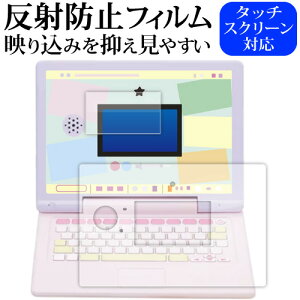 J IN I}EXłI݂R炵p\R MYLIVE [ ʗp ӂp 2Zbg ] tی tB ˖h~ mOA jgs bgt ݊i