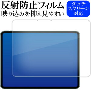 OnePlus Pad [ tp ] ( 11.6C` ) tی tB ˖h~ mOA [֑ jgs bgt ݊i