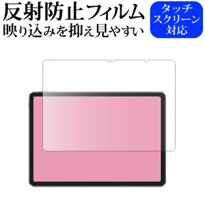 XP-Pen Magic Drawing Pad tی tB ˖h~ mOA [֑ jgs bgt ݊i
