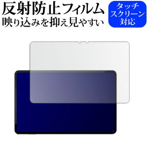 AvidPad A90 ( 12C` ) tی tB ˖h~ mOA [֑ jgs bgt ݊i