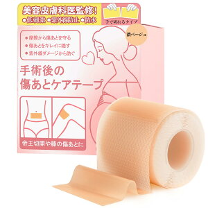 yzye畆Ȉ㐄zՃPAe[v 鉤؊J e[v PCh΍p p̏ƕی wh×ɂ₳xVRWFV[gwŐ؂^Cvxi4cm×150cm