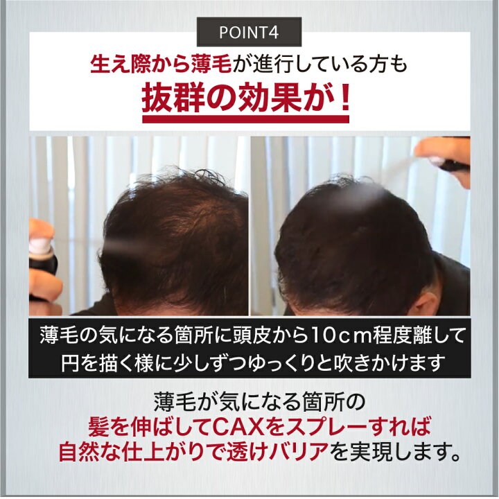 楽天市場】薄毛隠し 増毛スプレー CAX ボリュームアップスプレー 1本 