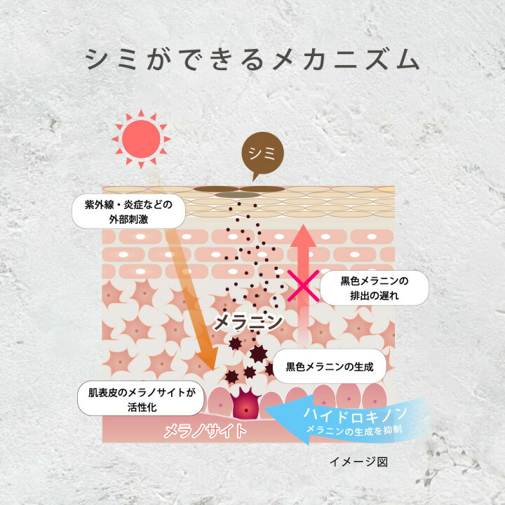 楽天市場】美st4月号＼10万本突破／ 楽天1位 ハイドロキノン クリーム 