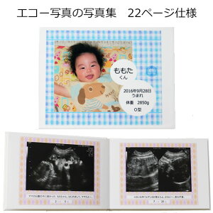 マタニティ アルバム エコー写真の通販 価格比較 価格 Com マタニティ アルバム エコー写真の通販 価格比較 価格 Com