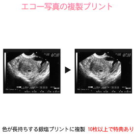 エコー写真の複製プリント エコー写真を色が長持ちする銀塩印画紙にプリント 10枚以上のご注文で特典あり! マタニティアルバム エコー写真 保存 マタニティ エコー アルバム データ保存 cd 写真プリント マタニティアルバム用 写真保存 写真印刷 高品質 銀塩プリント