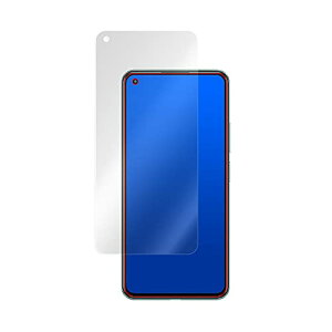 �~���r�b�N�X ���˖h�~ �t���ی�t�B���� �h�w�� �h�C�A Xiaomi Mi 11 Lite 5G �p ���{�� OverLay Plus OLMI11LITE5G/F/12