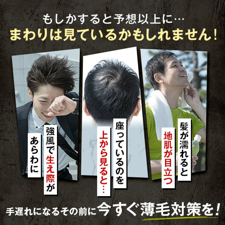 楽天市場】初回全額返金保証書付 送料無料 公式 チャップアップ 育毛 