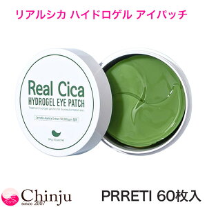 PRRETI vbeB AVJ nChQ ACpb` 1 60 ACPA XLPA ێ V[g ؍RX