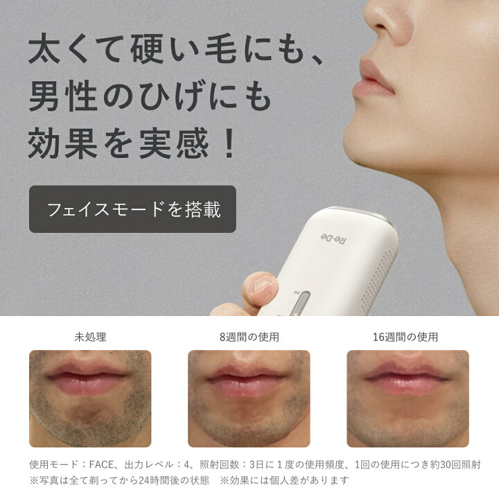 楽天市場】【正規品】リデ デュオクリア IPL 脱毛器 Re・De DuoClear 
