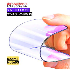 Xiaomi u[CgJbg Z~bN A`OA tB Ȃ یtB VI~ bh~[ 14T 14T Pro 13T 13T Pro 12T 12T Pro 11T 11T Pro Redmi Note 13Pro 11Pro 11 10T 10Pro 9S 9T Redmi 12 POCO F4 GT