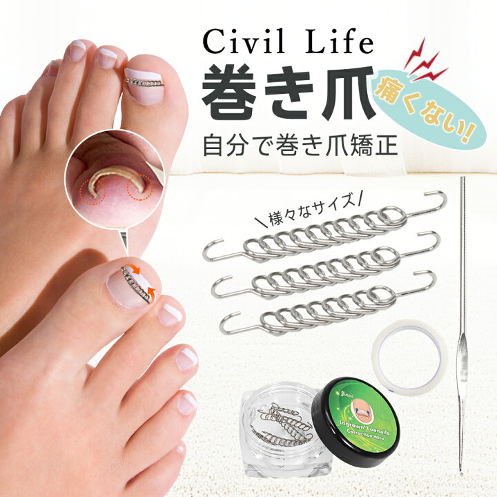 楽天市場】[Civil Life]巻き爪 矯正 巻き爪矯正グッズ 巻き爪チェーン 