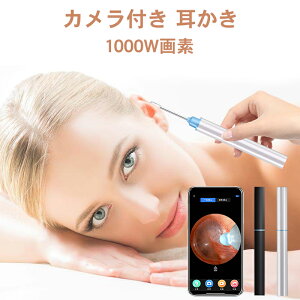  | C[XR[v Android iphoneΉ XR[v LEDCg CX J 鎨 쎨 f  x pI qǂ ^Y 1000f