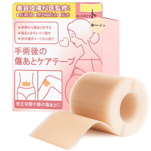 yzy畆ȐďCzՃPAe[v 鉤؊J e[v PCh e[v p̏e[v ƃPAe[v VRe[vi4cm×150cmj