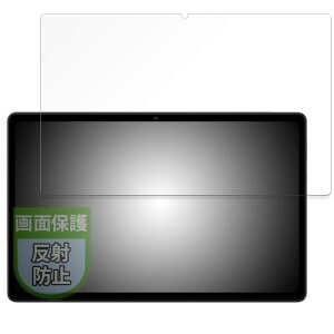 MotoMoto �t�B���� AvidPad S60 / S60-15 �p �ی�t�B���� ���˒ጸ �w��h�~ ���{��