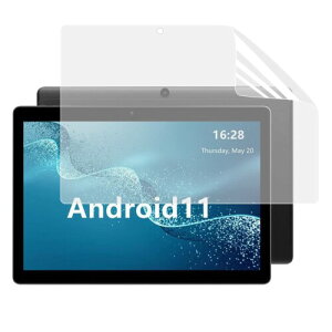 ALLDOCUBE iPlay20S 10.1 p u[CgJbgtB ˒ጸ R A`OA wh~ CAh~ t یtB ʕیV[g