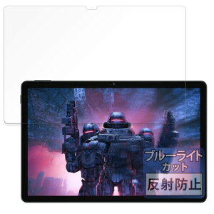 FILMEXT �t�B���� DOOGEE U11 �p �ی�t�B���� �u���[���C�g�J�b�g ���˒ጸ