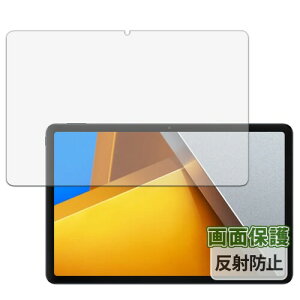 Kayo&Karin Xiaomi POCO Pad p tB ˒ጸ یtB wh~ {