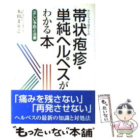 楽天市場 帯状疱疹 本田まりこの通販 楽天市場 帯状疱疹 本田まりこの通販