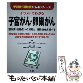 楽天市場 イラストでわかる子宮がんの通販