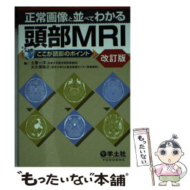 【中古】 正常画像と並べてわかる頭部MRI ここが読影のポイント 改訂版 / 土屋 一洋, 大久保 敏之 / 羊土社 [文庫]【メール便送料無料】【あす楽対応】