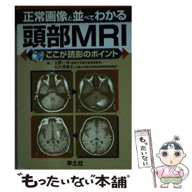 【中古】 正常画像と並べてわかる頭部MRI ここが読影のポイント / 土屋 一洋, 大久保 敏之 / 羊土社 [文庫]【メール便送料無料】【あす楽対応】